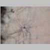 Neuronas Golgi 25.jpg
